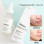 The Ordinary Niacinamide 10% + Zinc 1% 30ml - Image 3